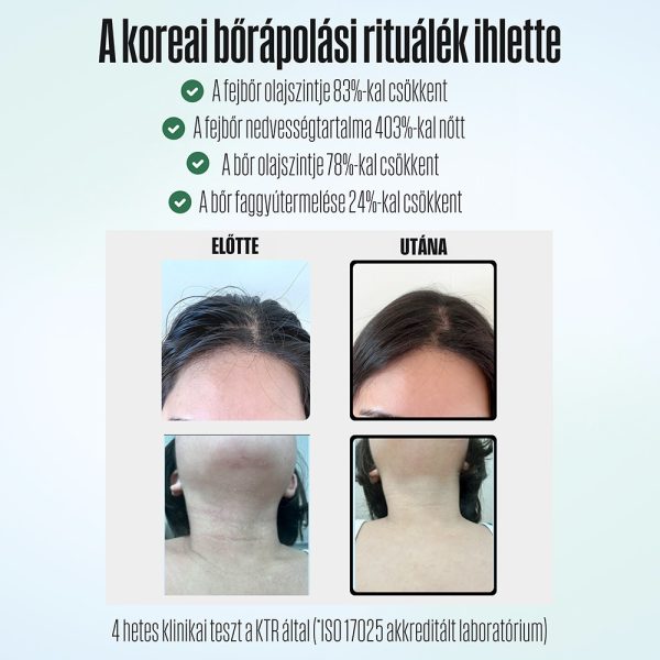 POSEION BT100® Prémium koreai revitalizáló zuhanyfej vízszűrővel, mágneses-ionizáló technológiával, szürke - BT100DG - Image 3